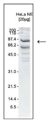 Western Blot: SSRP1 Antibody [NBP3-18676] - Figure 1. Western blot analysis using the antibody directed against hSSRP1 Western blot was performed on nuclear extracts from HeLa cells (20 ug) using the antibody against hSSRP1 diluted 1:1,000 in TBS-Tween containing 5% skimmed milk. A molecular weight marker (in kDa) is shown on the left. The location of the protein of interest is indicated by an arrow.